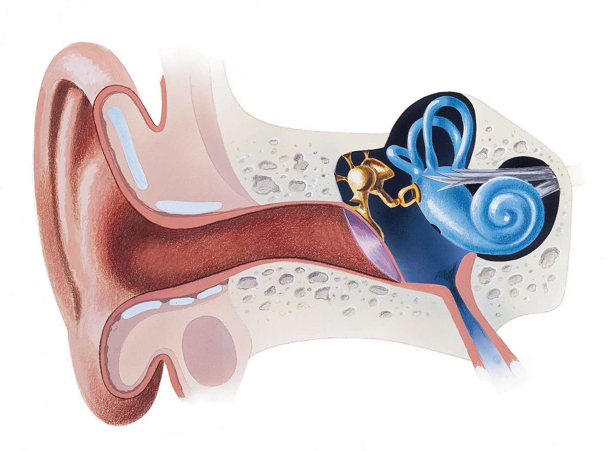 Улитка и слуховой нерв. Болезни внутреннего уха Меньера. Гидропс внутреннего уха болезнь Меньера. Кохлеарный неврит барабанная перепонка. Болезнь Меньера внутреннее ухо.
